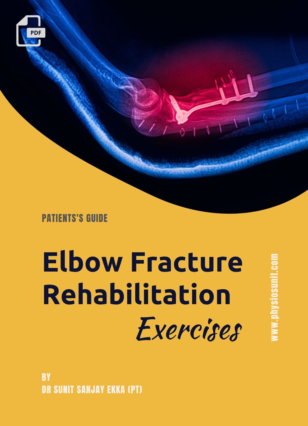 elbow fracture rehab exercises